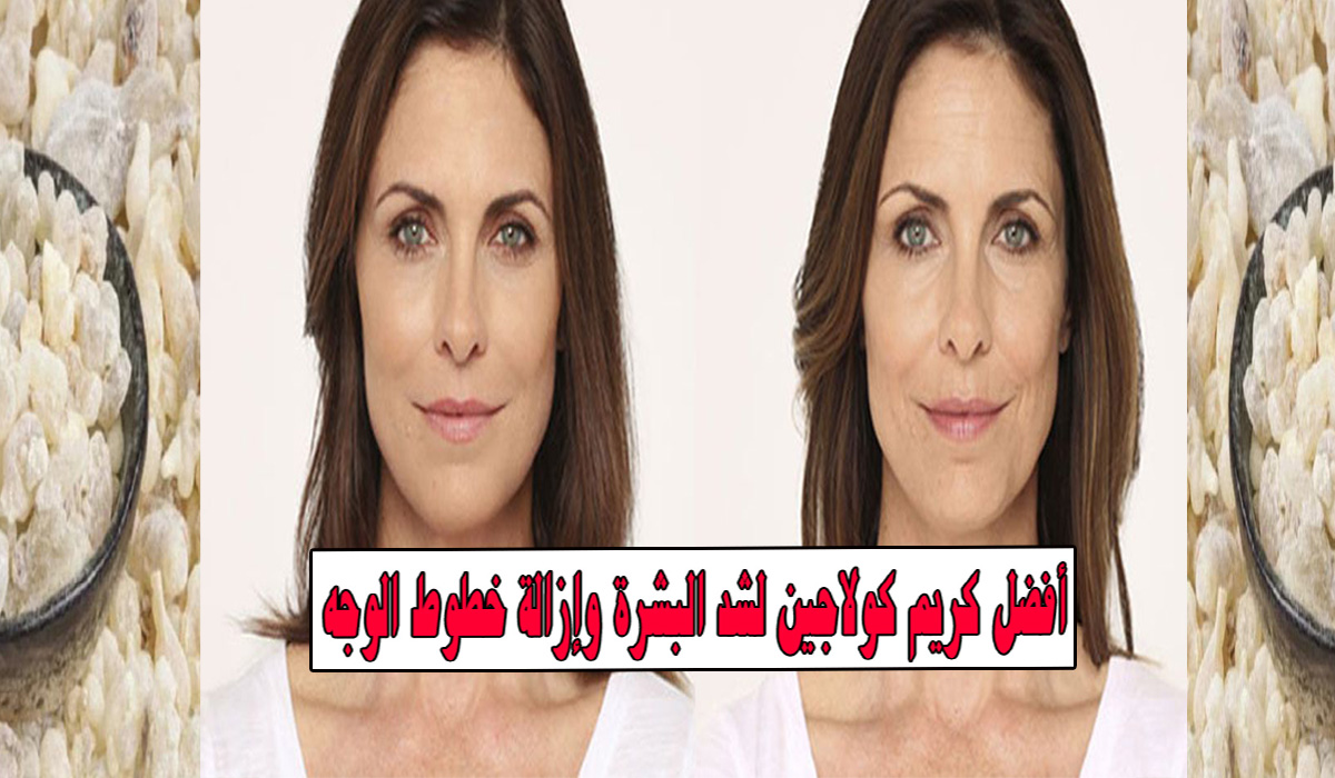 كريم ازالة التجاعيد