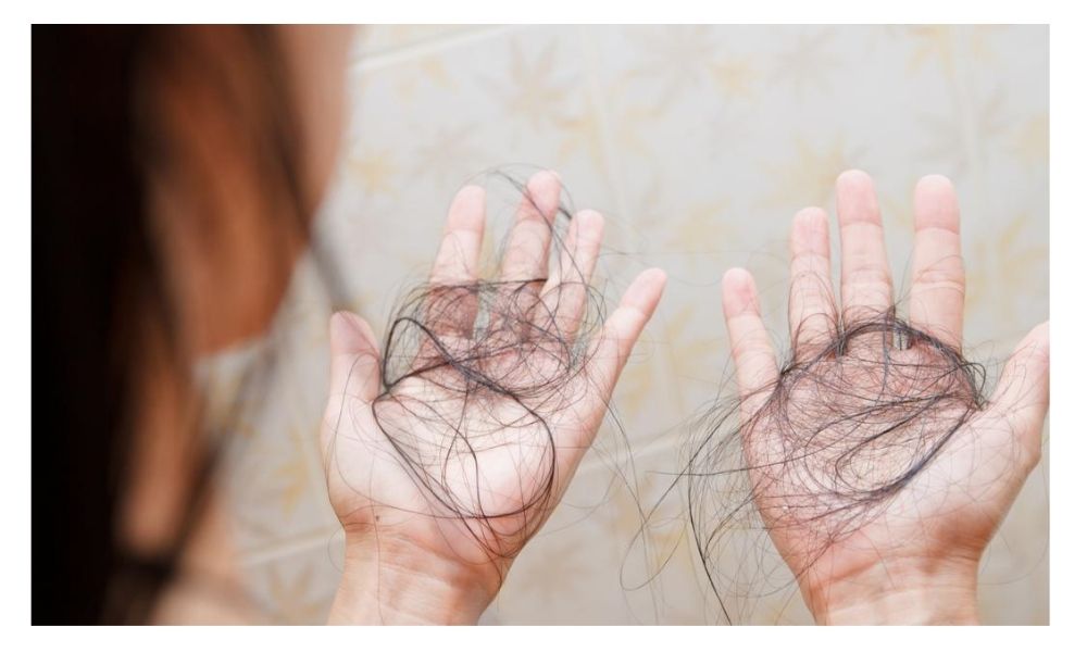 أسباب تساقط الشعر لدى الرجال والسيدات – طريقة العلاج بـ زيوت من خلاصة الطبيعة