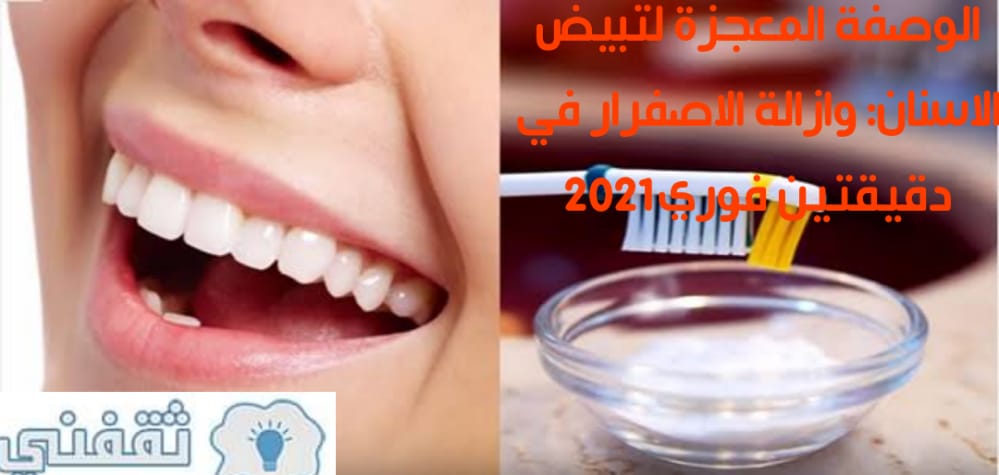 الوصفة المعجزة لتبيض الاسنان