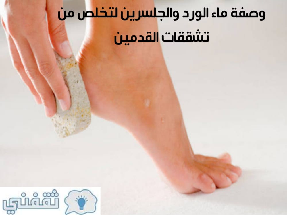 كريم لتشققات القدمين