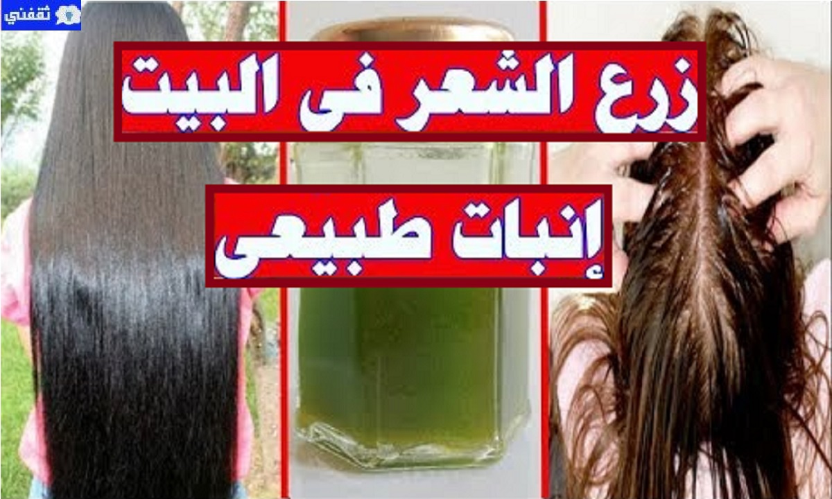 إنبات فراغات الشعر