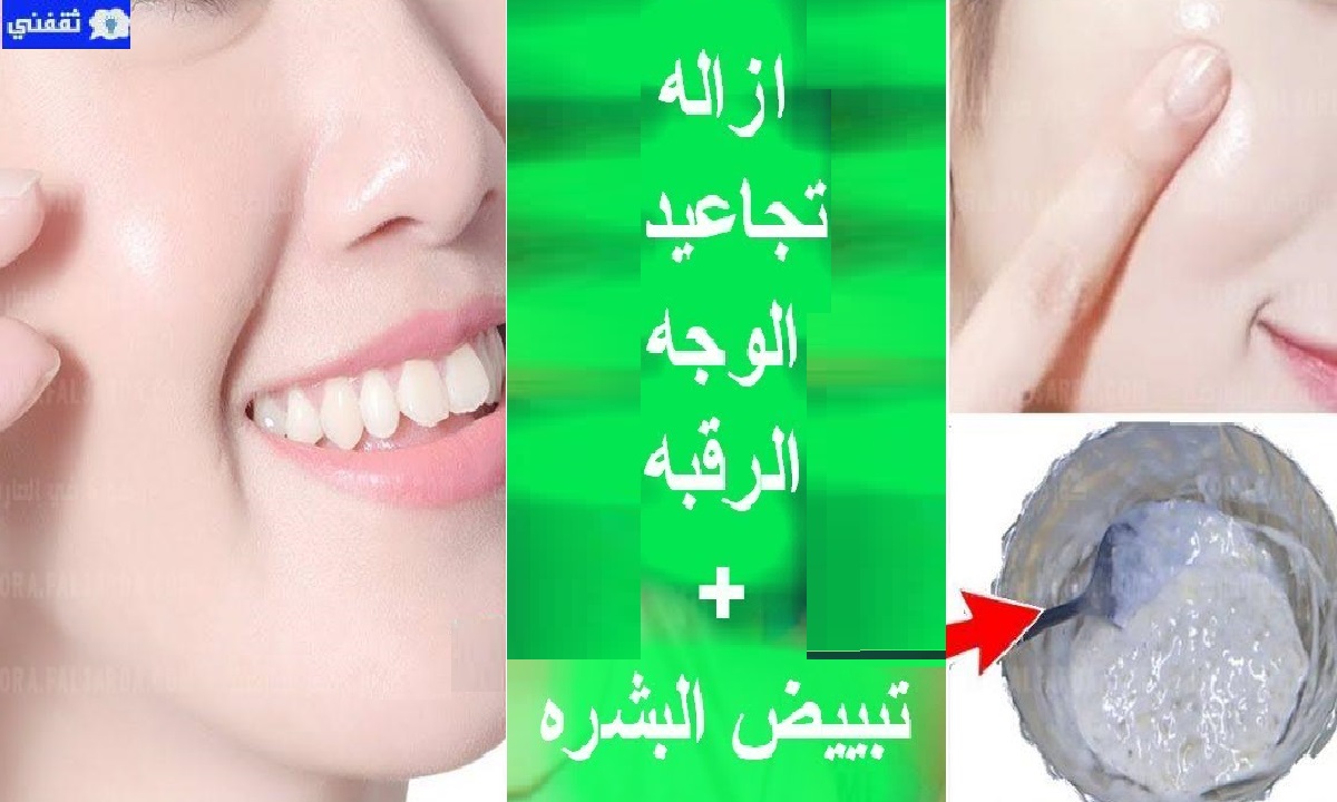 تبييض البشرة