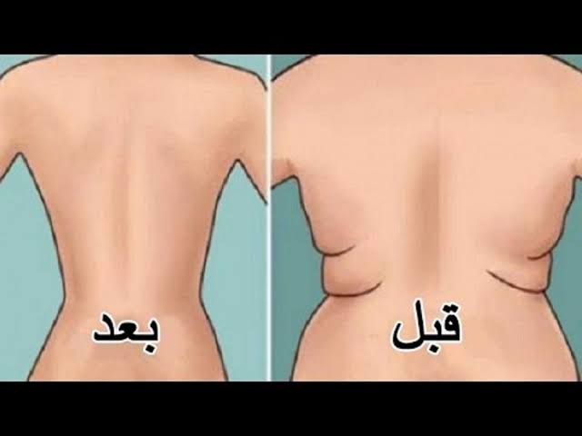 طرق التخلص من دهون الظهر