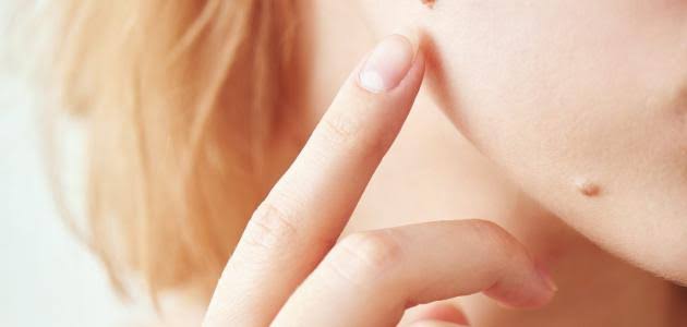 كيفية إزالة زوائد الجلد من الوجه