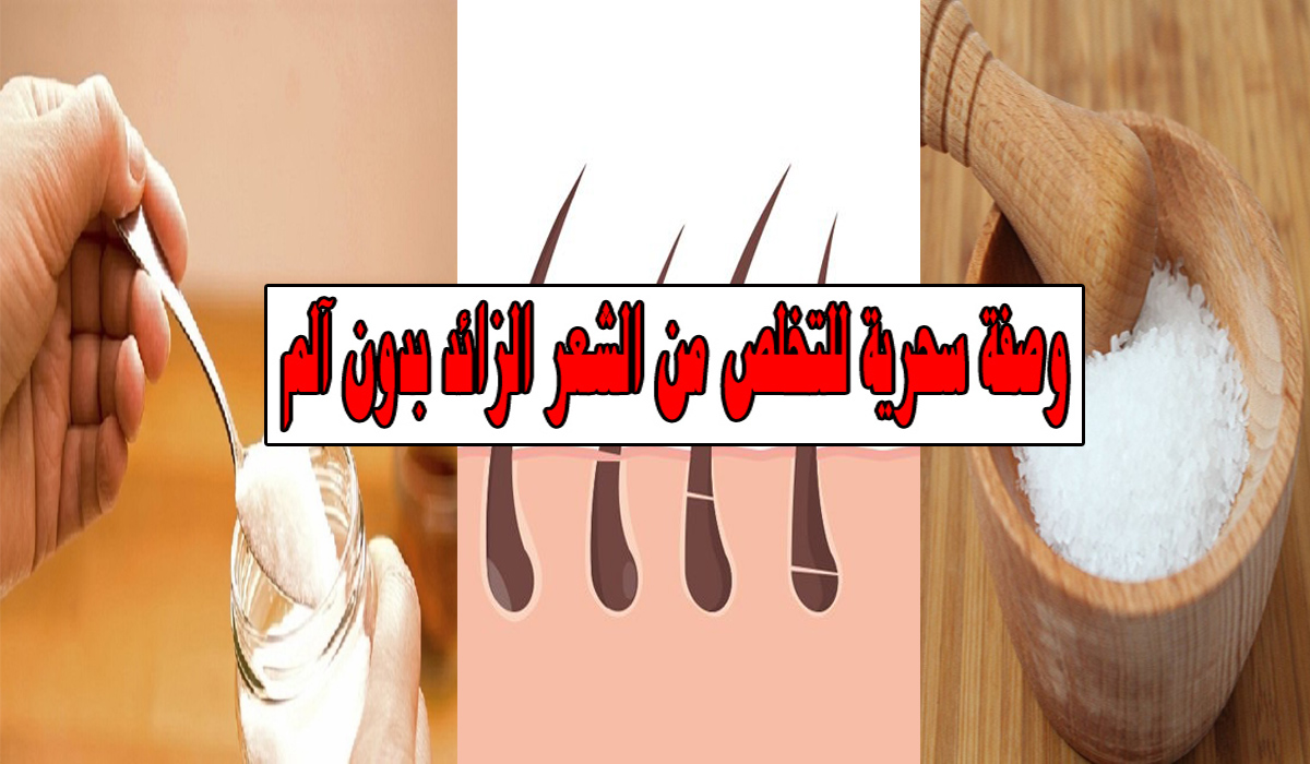 ازالة الشعر