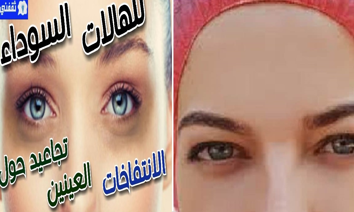 التخلص من الهالات والتجاعيد