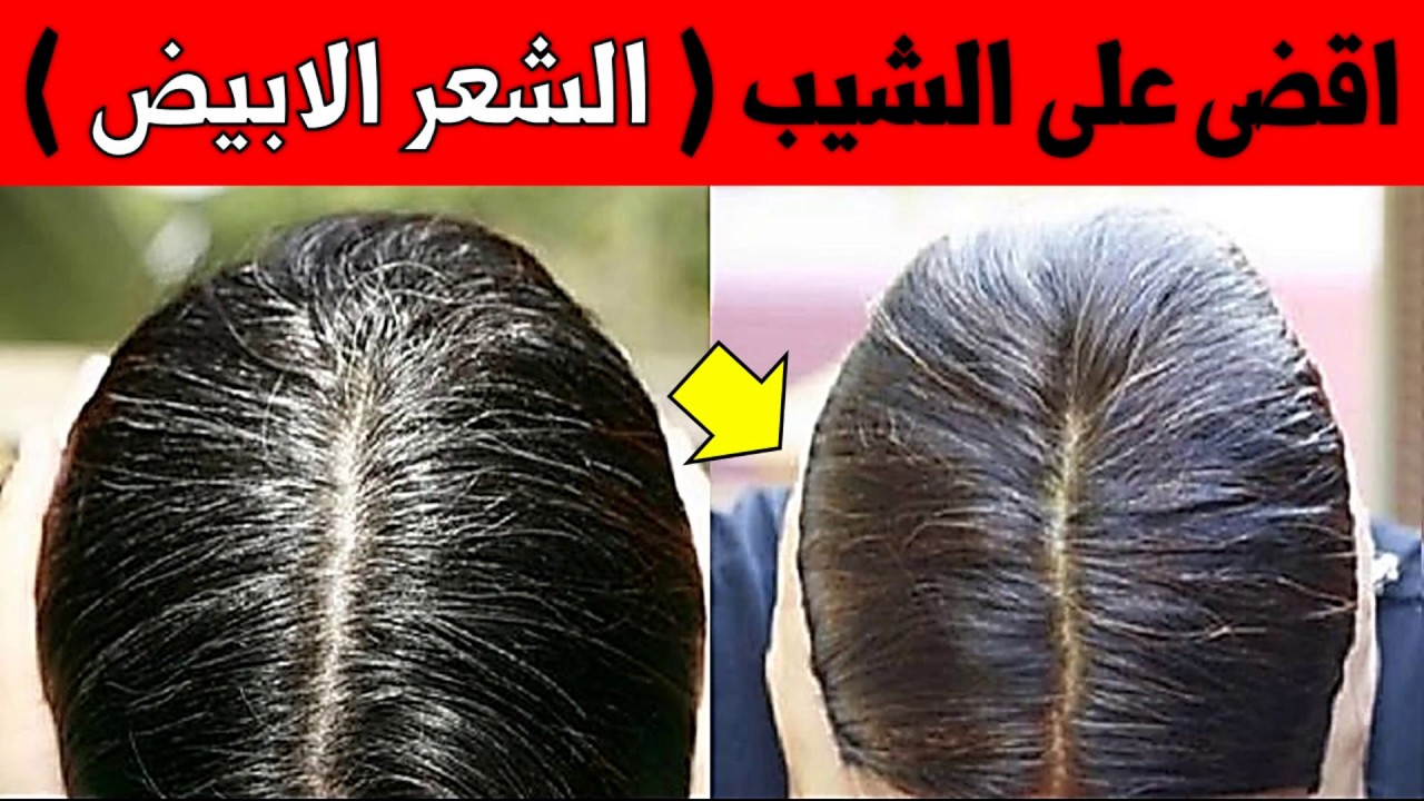 الخلطة الفرعونية للتخلص من شيب الشعر والحفاظ على الشعر وبدون أي مواد كيميائية من أو ل أسبوع