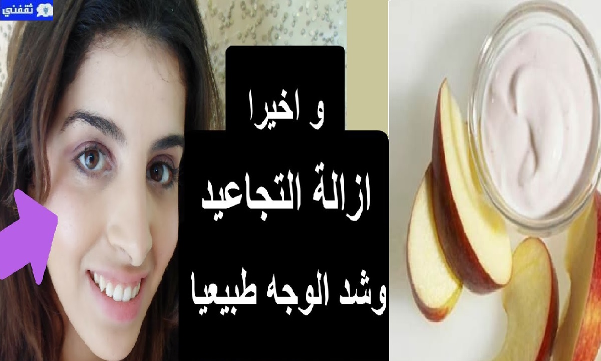 تبييض البشرة السمراء