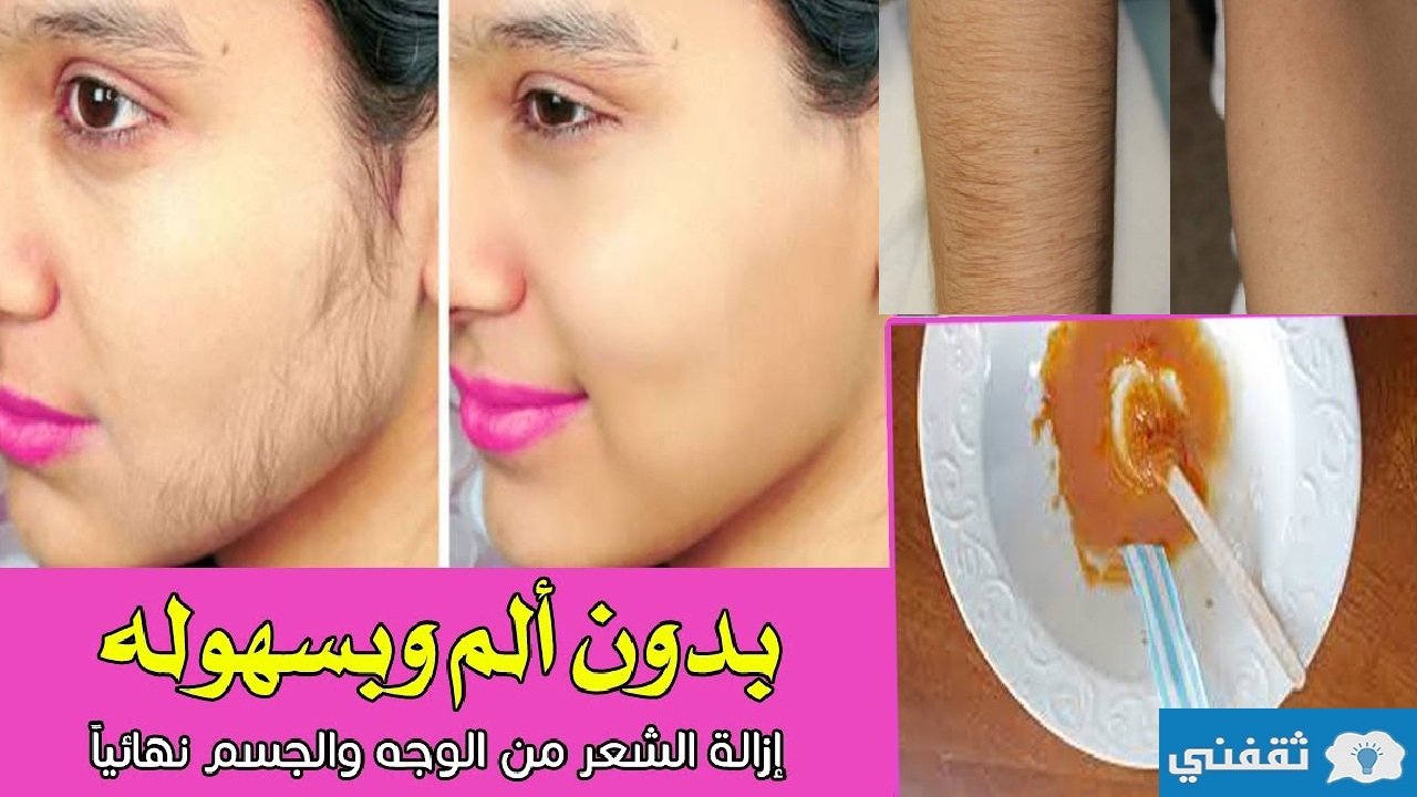 ديل الليزر الأقوى لإزالة شعر الوجه والجسم