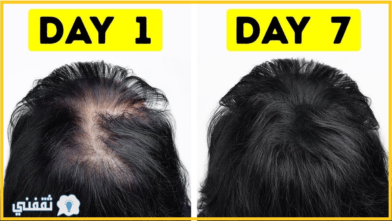 كيفية تكثيف الشعر في أسبوع