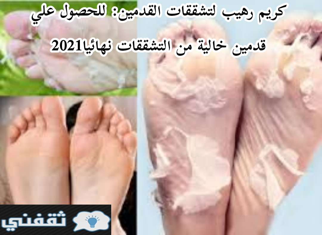 كريم رهيب لتشققات القدمين