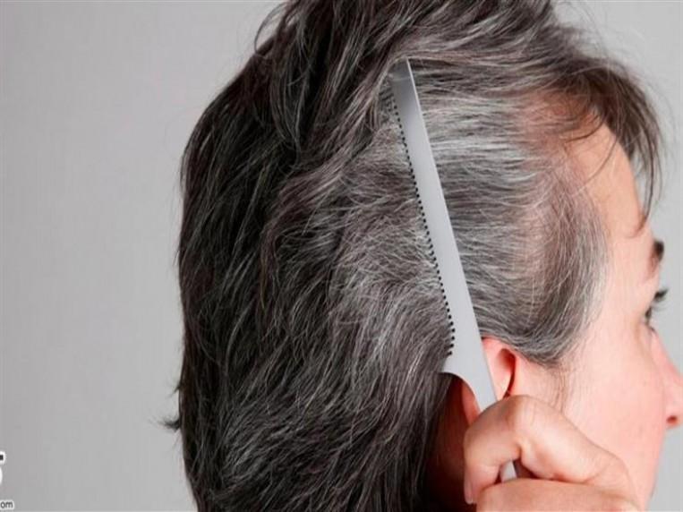 علاج الشعر الابيض والشيب المبكر بملعقة قرنفل واحدة في 5 دقائق سيعود شعرك للونه الطبيعي