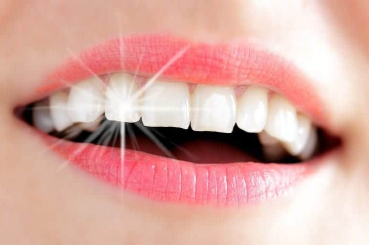 طريقة تبيض الاسنان