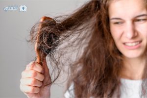 خلطة طبيعية لعلاج تساقط الشعر