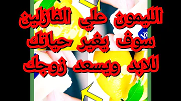 فوائد الفزلين