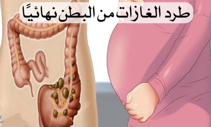 مشروب معجزة للتخلص من غازات البطن والانتفاخ في يوم واحد وداعاً للاحراج بعد الآن