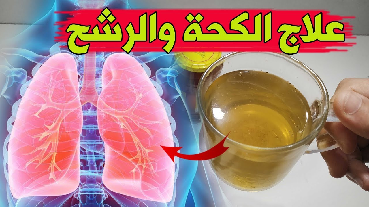 وداعاً للكحة.. مشروب معجزة لطرد البلغم وعلاج نزلات البرد والكحة الحادة بدون أدوية خلال ساعتين