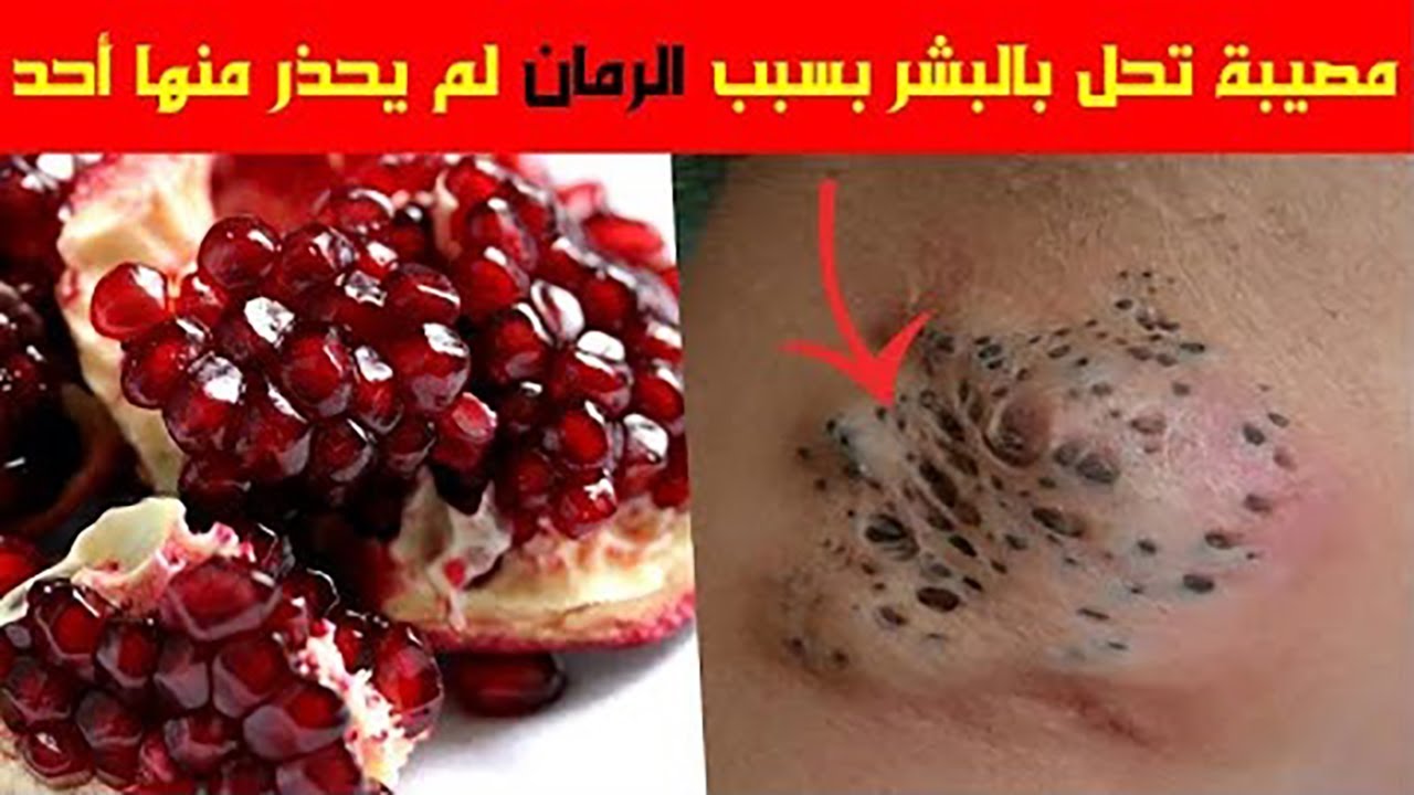 خطير جدا .. كارثة صحية مدمرة بسبب الرمان لم يعطها أحد إهتمام كيف يصبح الرمان سبب لهلاكنا رغم فوائده!!