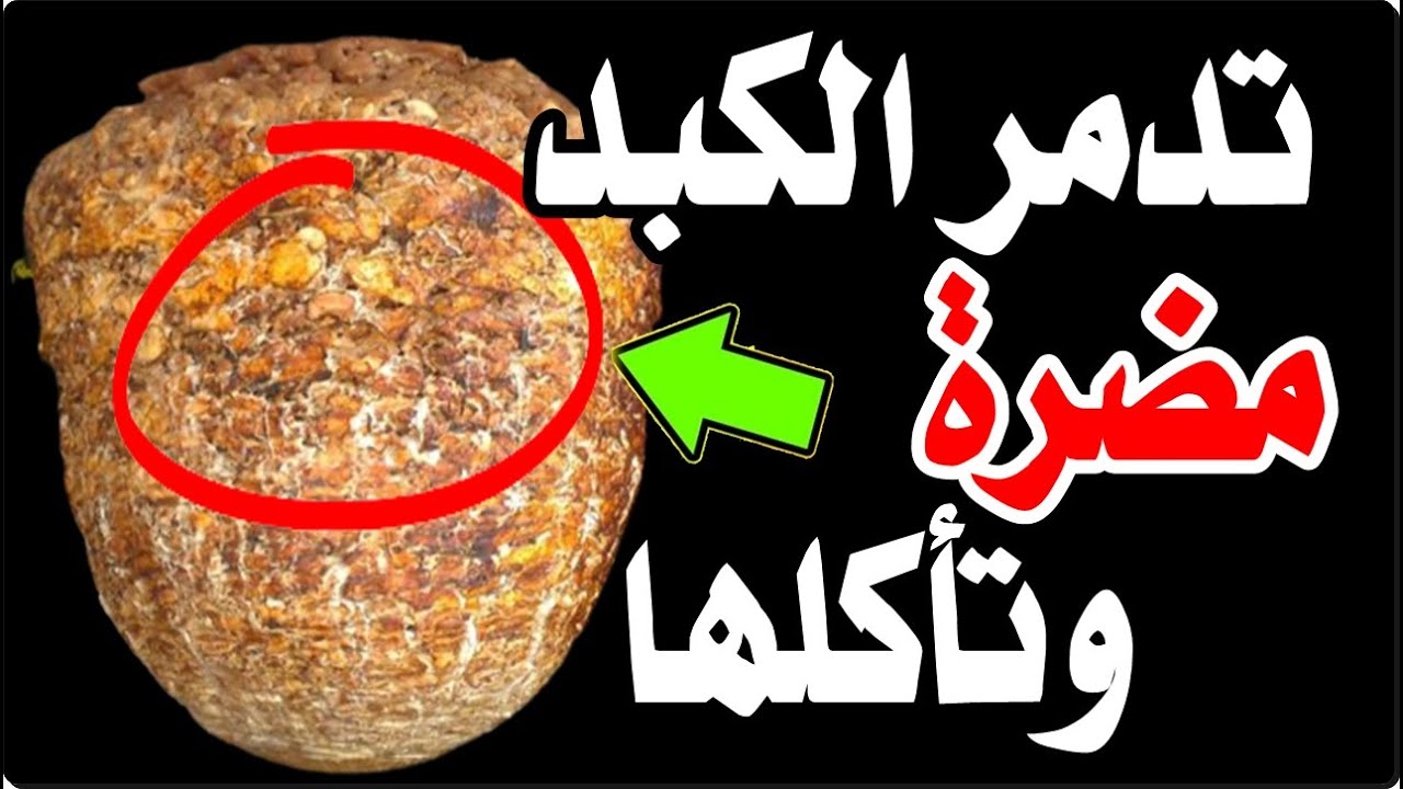 تدمر الكبد تشوش الدماغ تخرب المناعة تسد الشرايين تميت الخلايا والأعصاب تخرب القولون