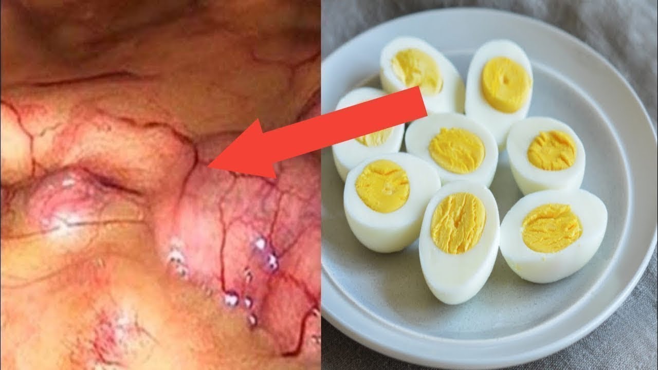 لن تصدق ماذا يحدث لجسمك عند تناول البيض المسلوق على معدة فارغة يومياً !! مفاجأة مذهلة