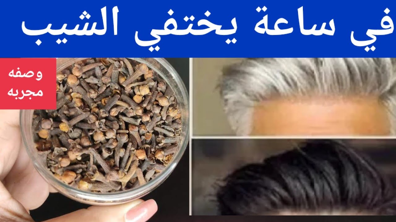 بدون صبغات ضارة.. معجزة القرنفل للتخلص من الشعر الأبيض نهائيا بدون رجوع مرة اخري