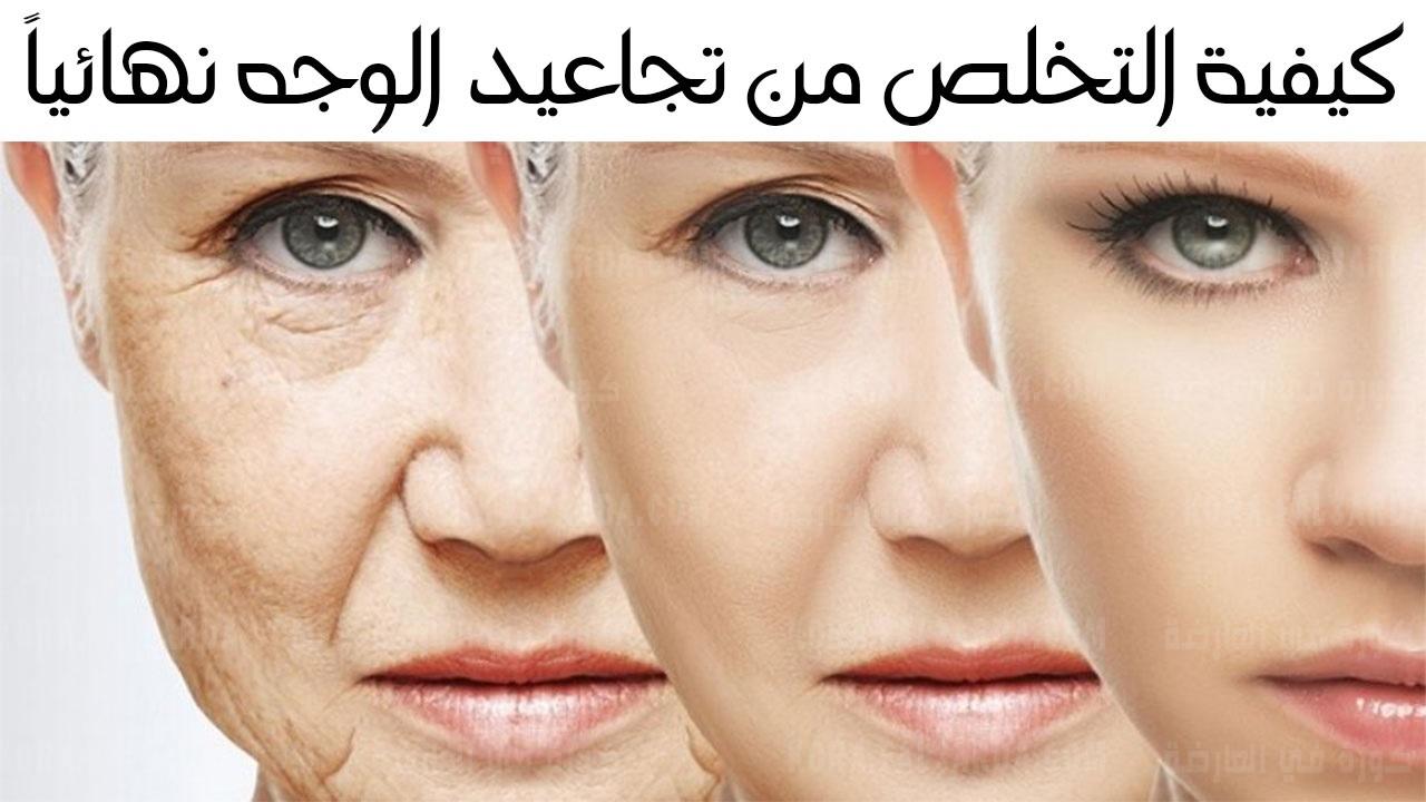 التخلص من التجاعيد