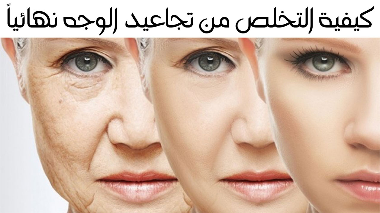 القضاء على التجاعيد