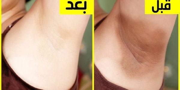 كريم تفتيح المناطق الغامقة بطريقة سحرية