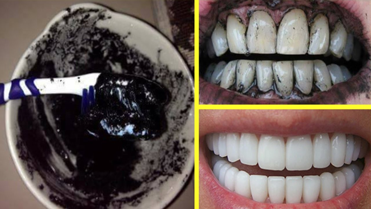 وصفات طبيعية لتبييض الأسنان وإزالة الجير