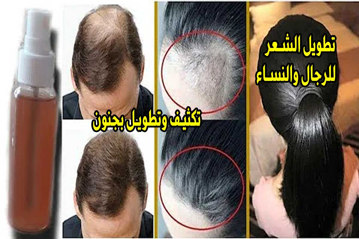 5. Naturlige håropskrifter ved hjælp af sort frøolie
