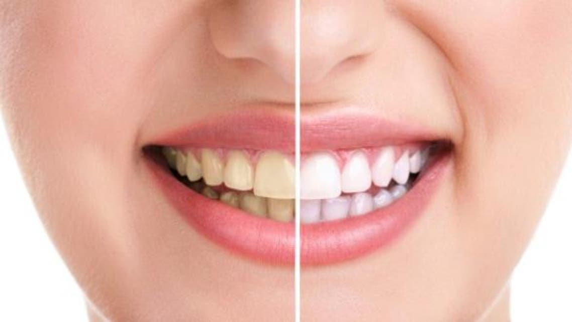 طريقة تبييض الاسنان طبيعيا
