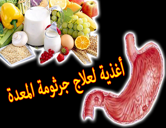 علاج جرثومة المعدة