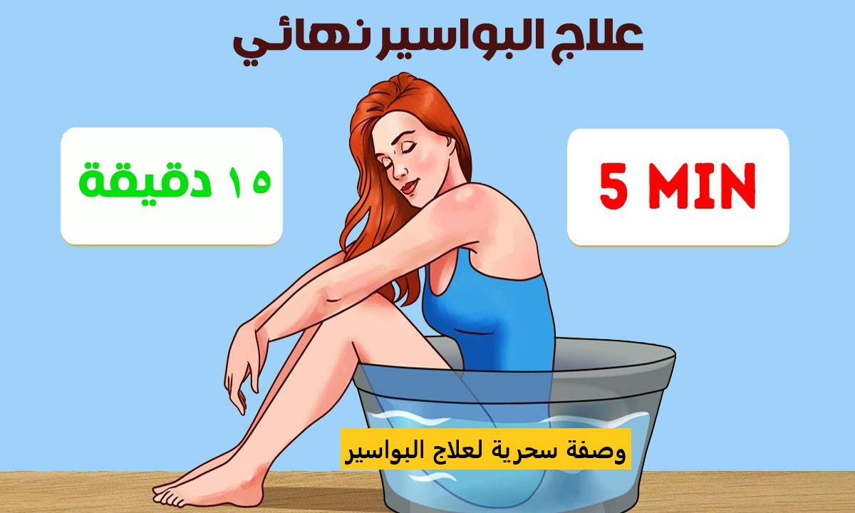 طريقة علاج البواسير