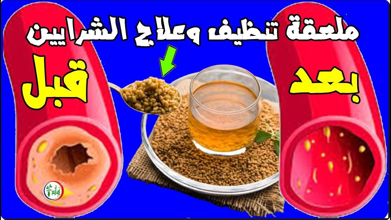 تنظيف وعلاج الشرايين