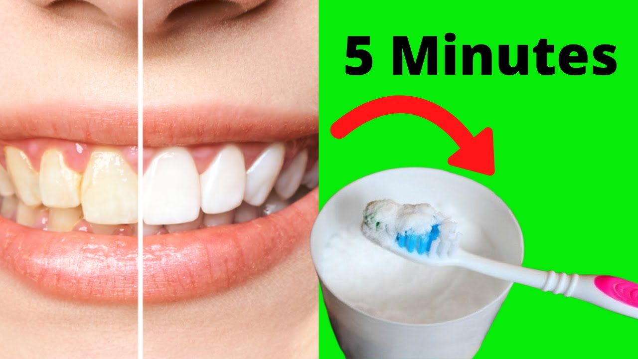 خلطات تبييض الأسنان في 5 دقائق