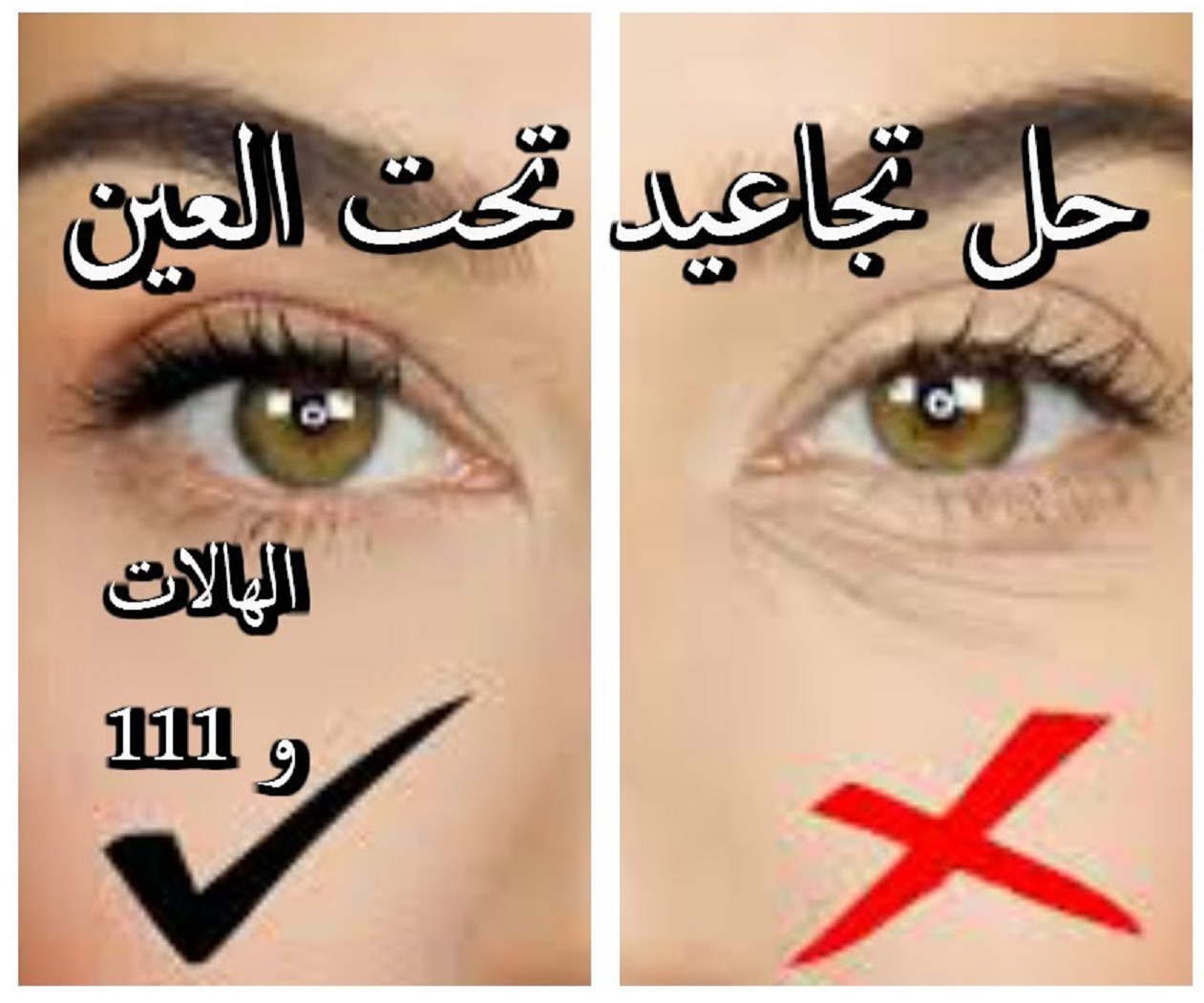 طريقة لإزالة الهالات السوداء وتجاعيد العين والوجه