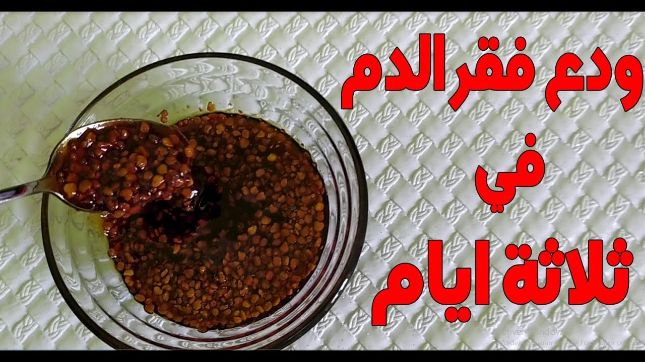 علاج فقر الدم