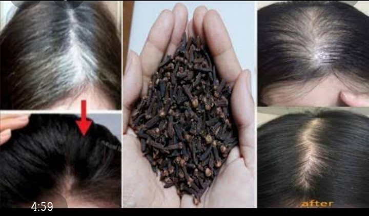 “القرنفل والقهوة معجزة للشيب”خلطة فاعلة في علاج والقضاء على شيب الشعر ومقوية للشعر