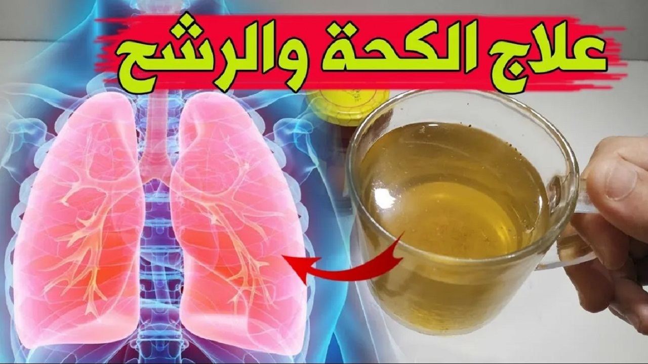 عندما تمتلئ رئتيك بالبلغم.. اقوى مشروب لطرد البلغم والكحة