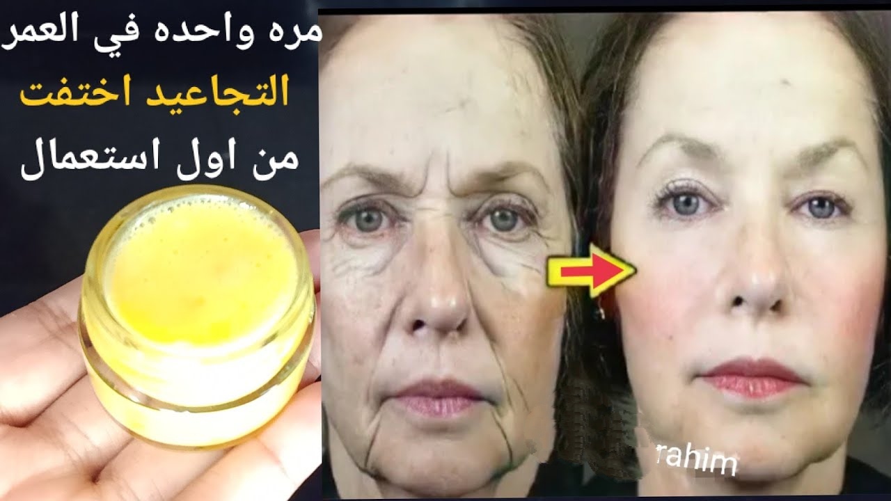 بوتكس طبيعي.. حتي لو عمرك 50 سنة ضعيها على التجاعيد والترهلات ستجعل وجهك أبيض مشدود كالزجاج