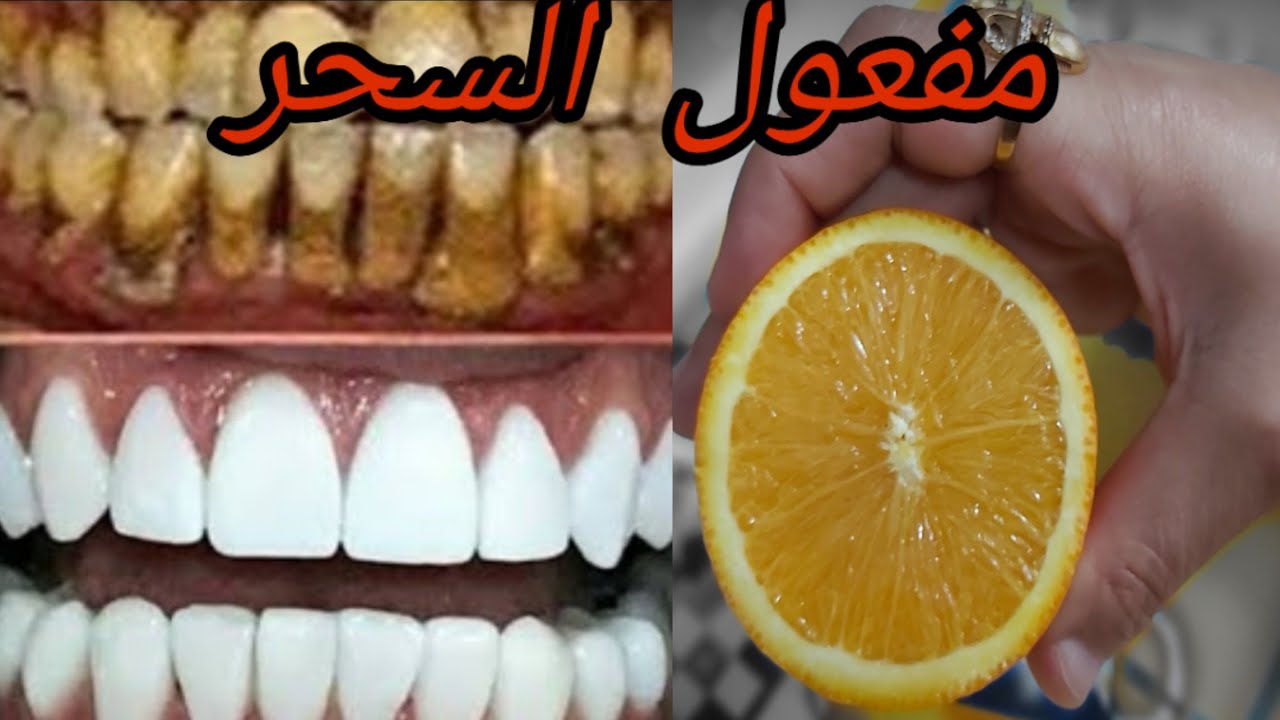 تبيض الاسنان كالؤلؤ في 3 دقائق وإزالة الجير والأصفرار أقوي من الليزر