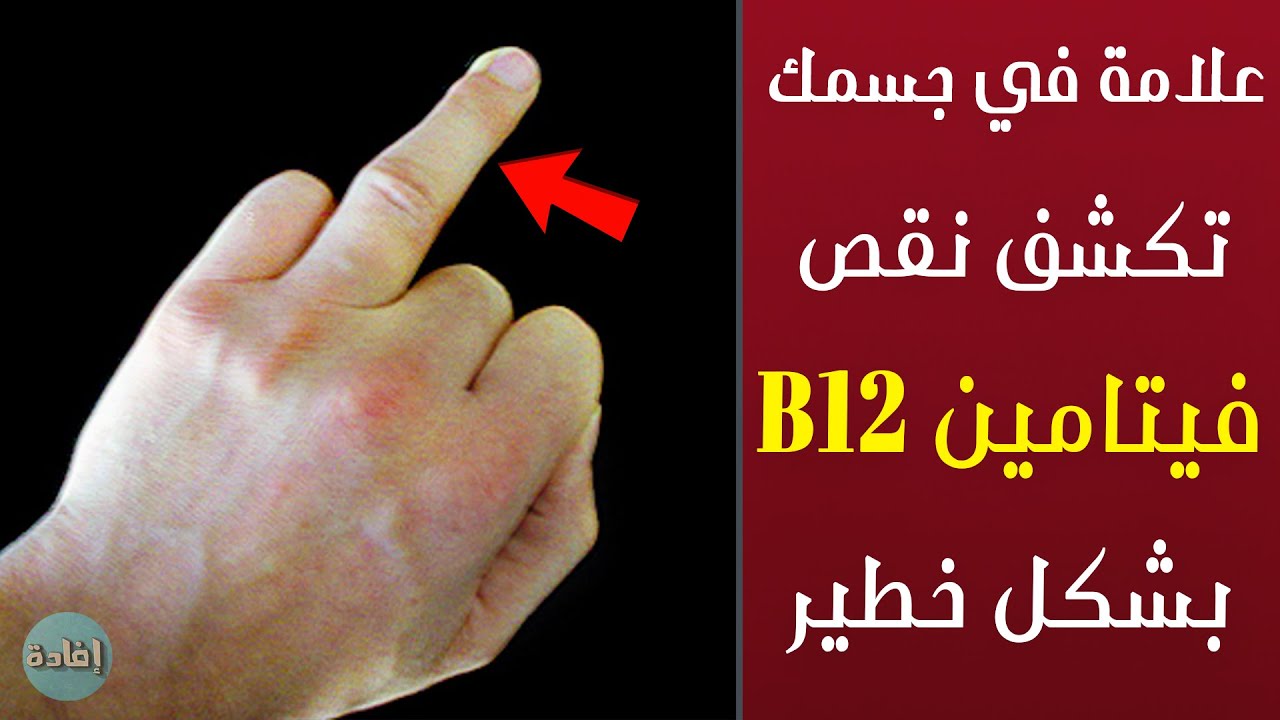 نقص فيتامين النساء أعراض b12 عند نقص فيتامين