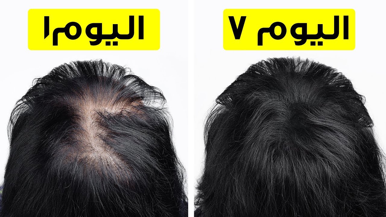 زيادة كثافة الشعر الخفيف