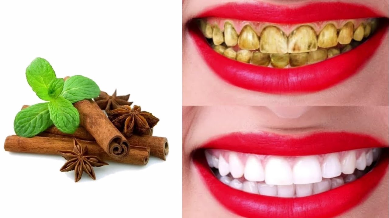 مكون معجزة لتبييض الأسنان ناصعة البياض كاللؤلؤ بدون جير ولا اصفرار بطريقة طبيعية فعالة