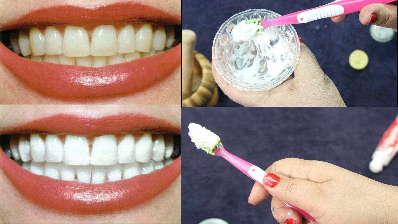 وصفة سحرية بسيطة لتبييض الأسنان كالثلج