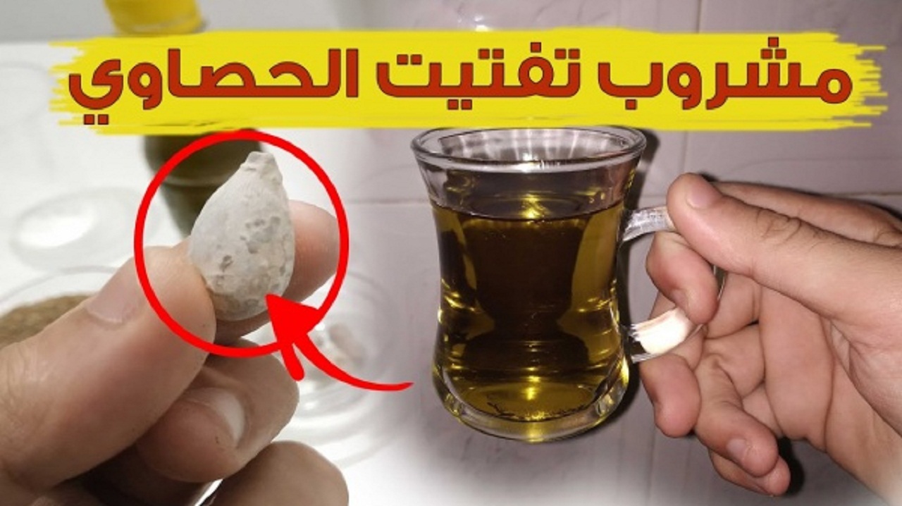 مش هتبطل تشربة.. اقوى مشروب لتفتيت حصوات الكلى