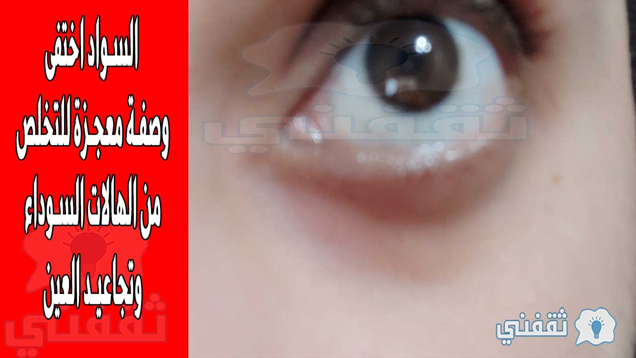 علاج التجاعيد السوداء