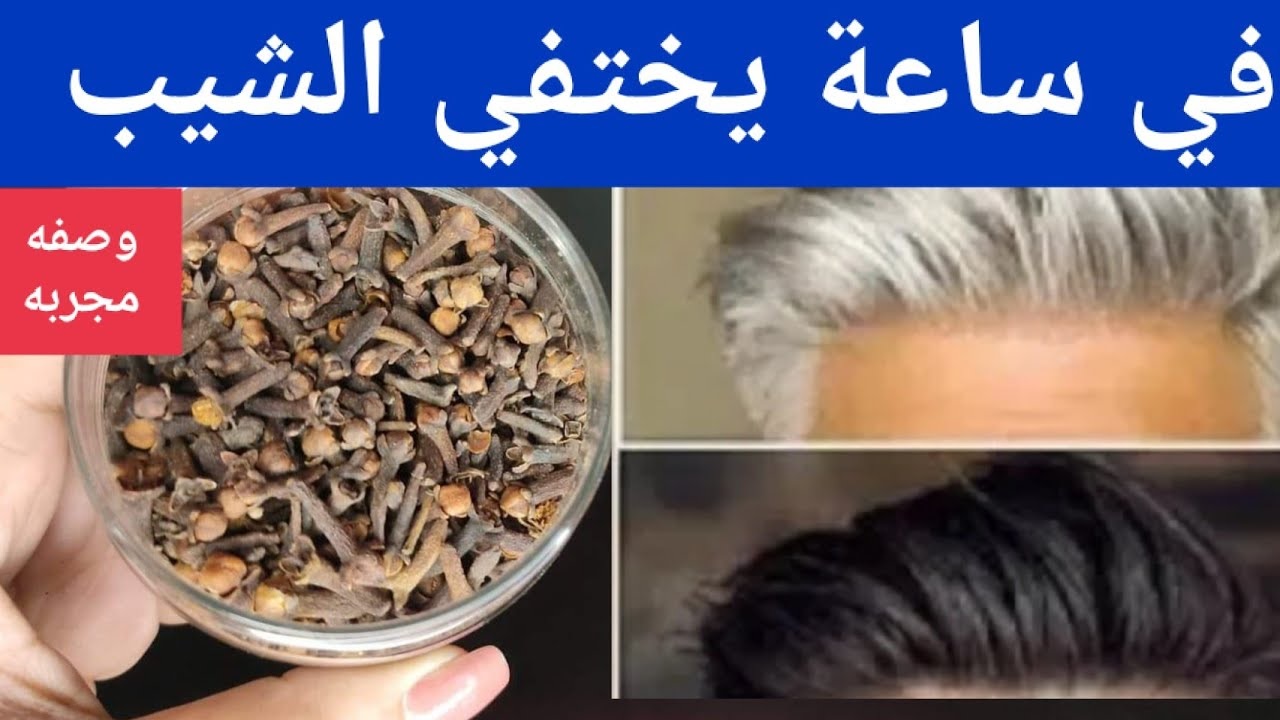 بدون حناء أو صبغات ضارة.. معجزة القرنفل للتخلص من الشعر الأبيض نهائيا في دقائق معدودة بدون رجوع مرة اخري