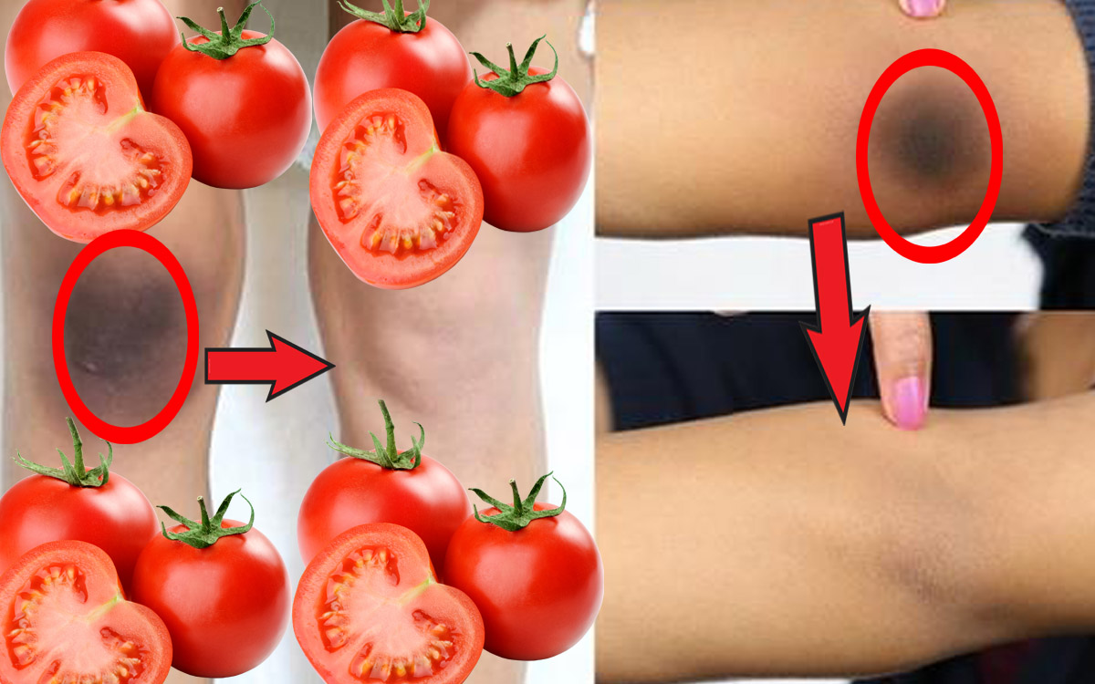 وصفة الطماطم والعدس لتبييض اليدين والقدم