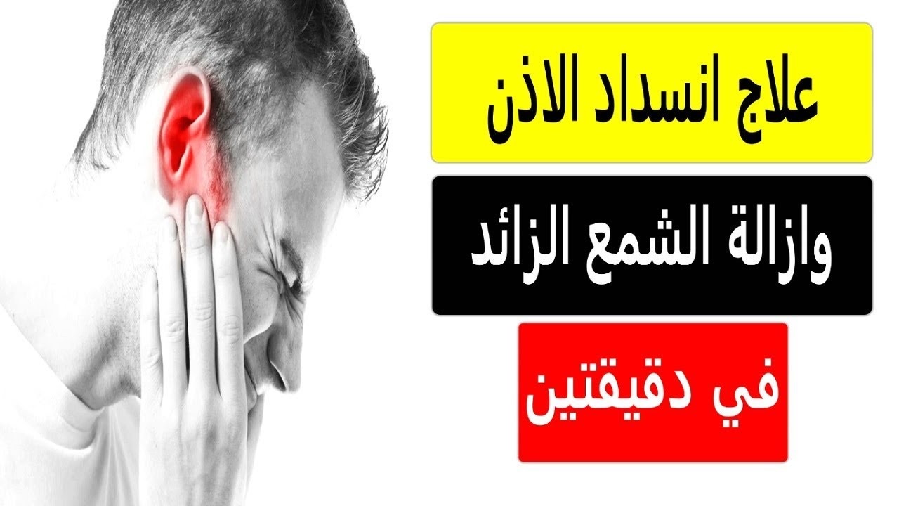 تنظيف الأذن من الشمع في المنزل بطريقة امنه